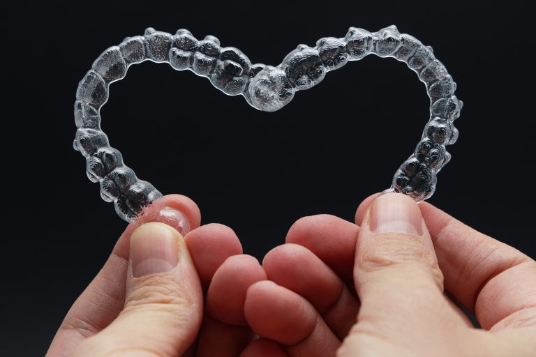 Consultation at Pro Aligners—discussion of costs and finance options